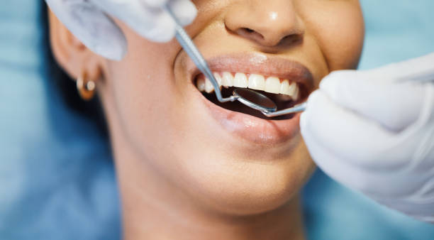 Best Emergency Wisdom Tooth Extraction in Kittredge, CO